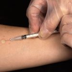 1200px-Mantoux_tuberculin_skin_test