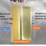 Bile-solubility-test