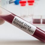 Blood-Urea-Nitrogen-BUN-Test
