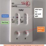 Hepatitis-A-virus-HAV-rapid-test