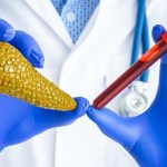 Lipase-Test