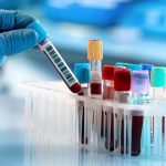 Liver-function-test