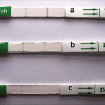Rapid-immunochroamtographic-rK39-dipstick-test-results-from-serum-samples-of-A