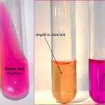 Result-Interpretation-of-Urease-Test