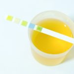 URINE-SUGAR-PP