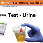 Urine-Sodium