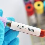 alkaline-phosphatase-test