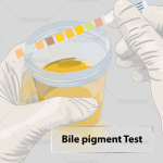 bile-pigment-test