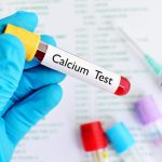 calcium-blood-test_thumb-1-732x549