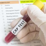 cpr-blood-test-in-vial-sample-in-front-of-document