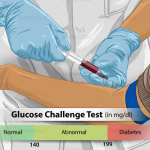 glucose-challenge-test-in-hindi