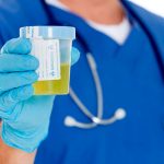 glucose-test-urine_thumb-1-732x549