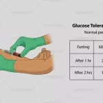 glucose-tolerance-test-kya-hai-kimat-aur-kaise-hota-hai