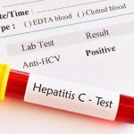 hepatitis-C-test