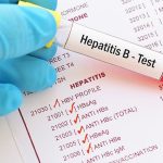 hepatitis-b-test (1)