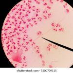 intracellular-gram-negative-diplococci-bacteria-260nw-1500709115
