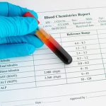 liver-blood-test-s13-rises-n-ast-alt