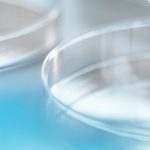 peritoneal-fluid-analysis-2x