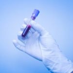 vial-2_12_16-300x200