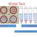 widal-test