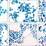 Fluid Cytology Rs 800