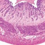 Histopathology (Medium Specimen) Rs. 1100