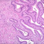 Histopathology (Small Specimen) Rs 700