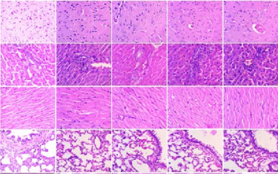 Histopathology