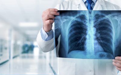 X-Ray-Facts