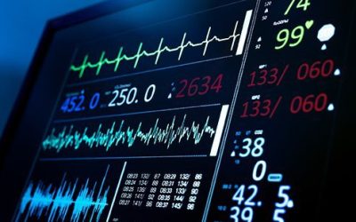 electrocardiogram